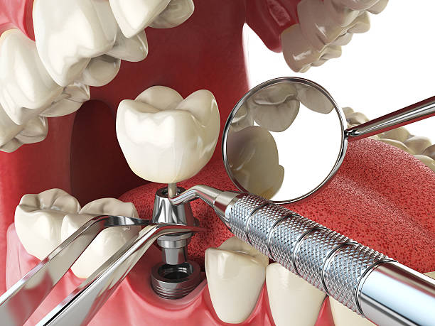 Best Emergency Treatment for Toothache in Jeanerette, LA